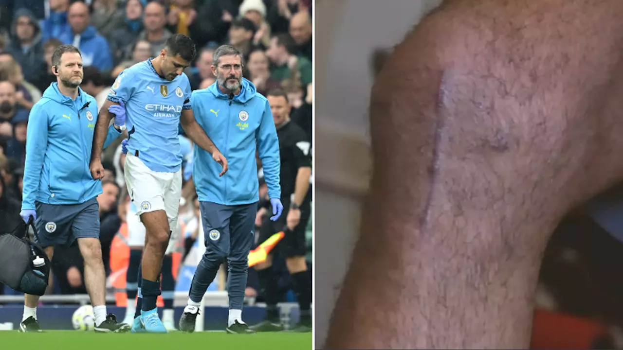 Fans express genuine concern after major Rodri injury update emerges just two months into recovery