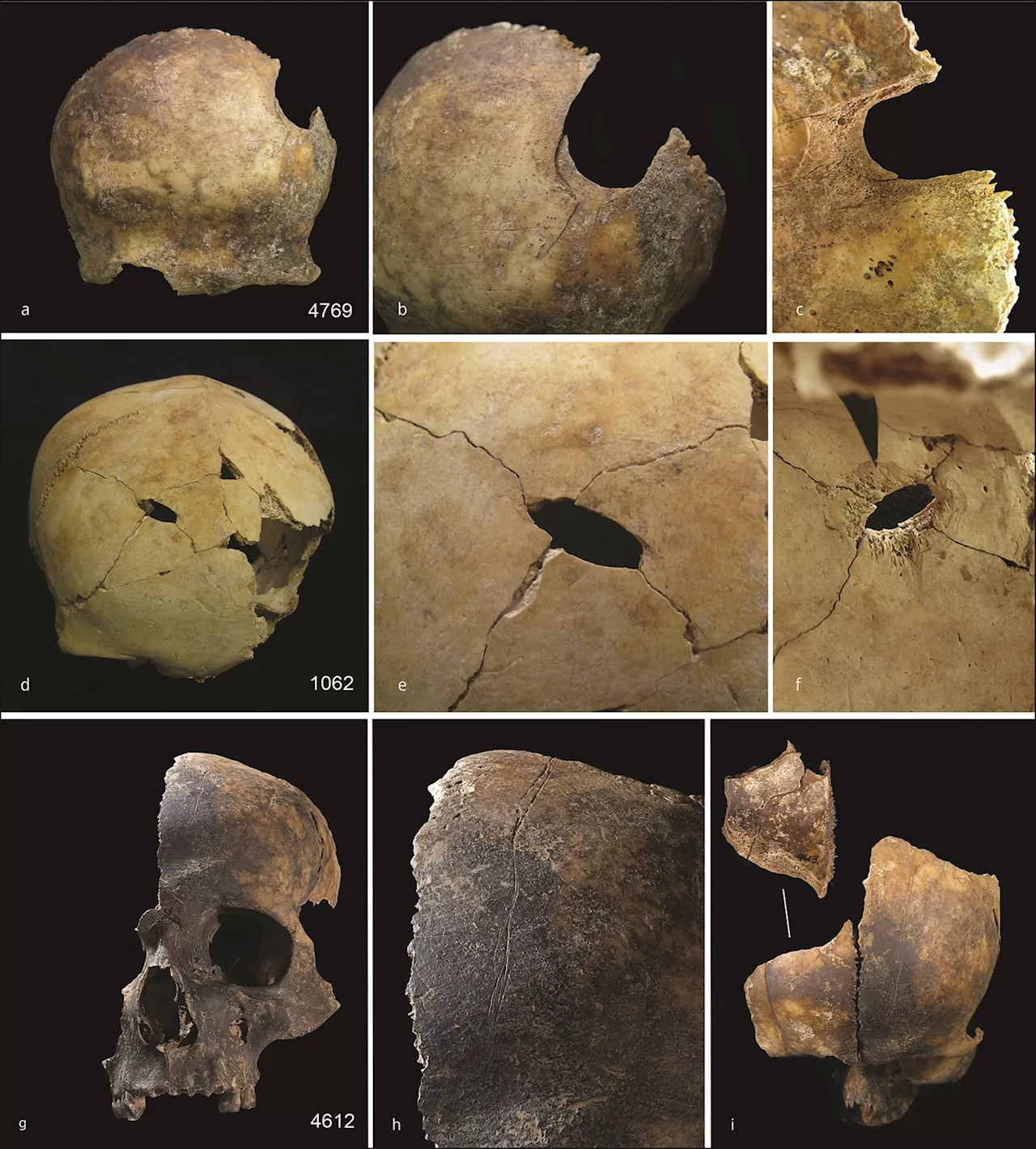 Bronze Age Bones Indicate Violent Death and Possible Cannibalism