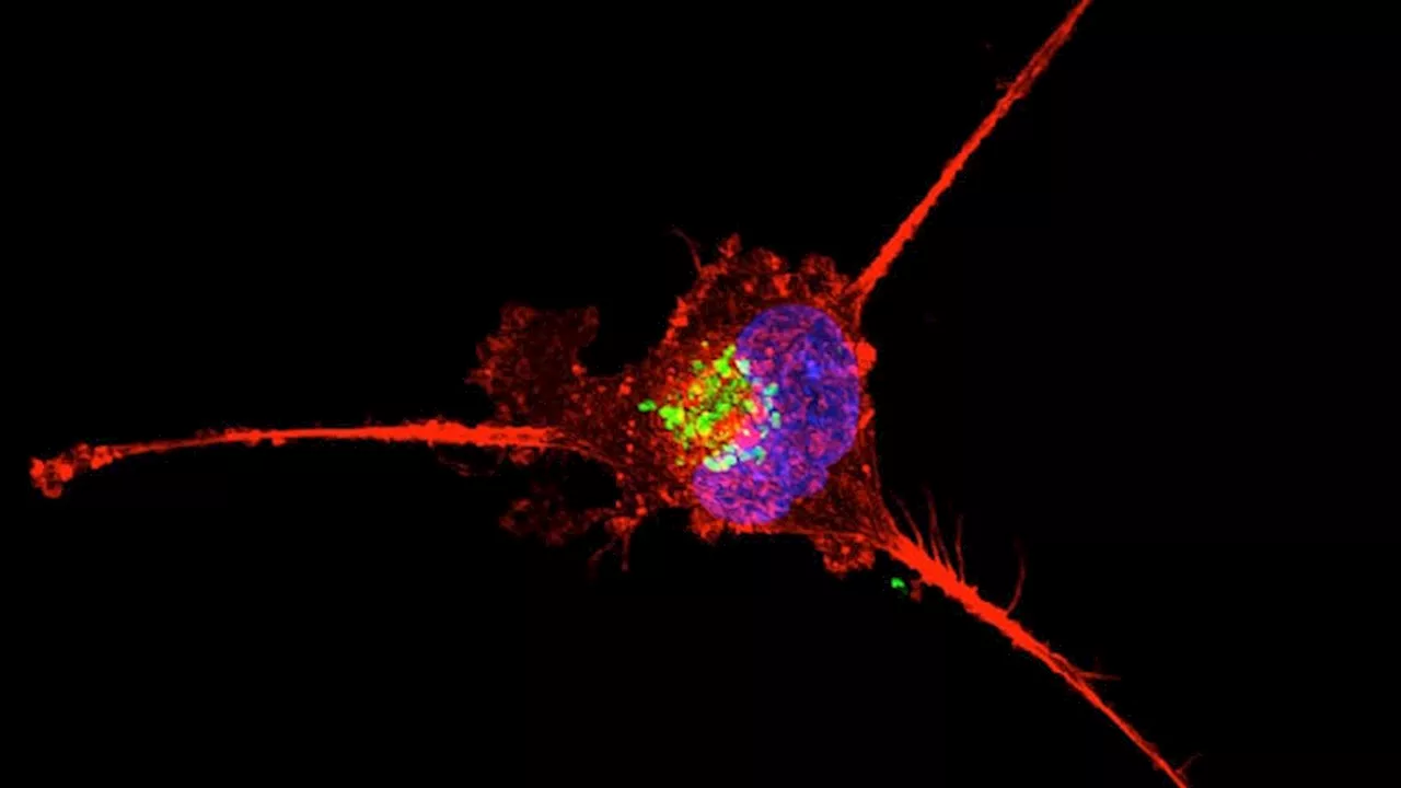 Biomarker Analyses Reveal Interplay Between Immune Signatures and Treatment Response in Early TNBC