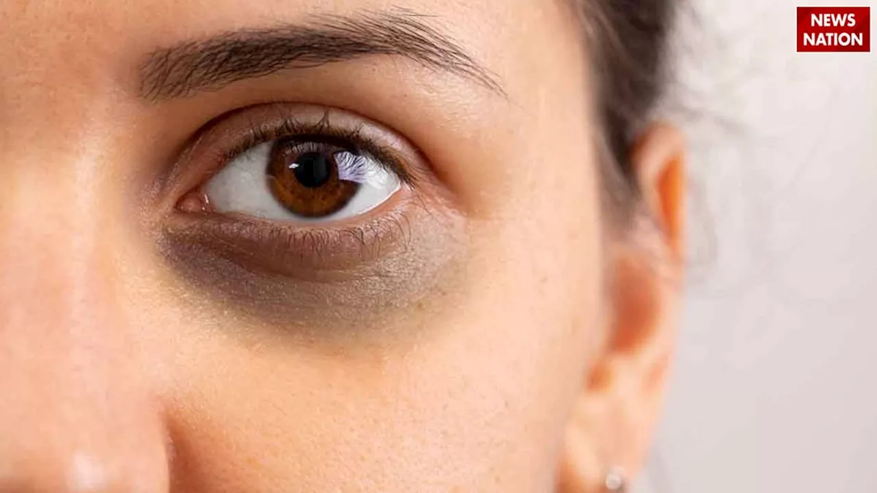 एक महीने में Dark Circles से छुटकारा दिलाएंगे ये 7 घरेलू उपाय, यहां देखें तरीका