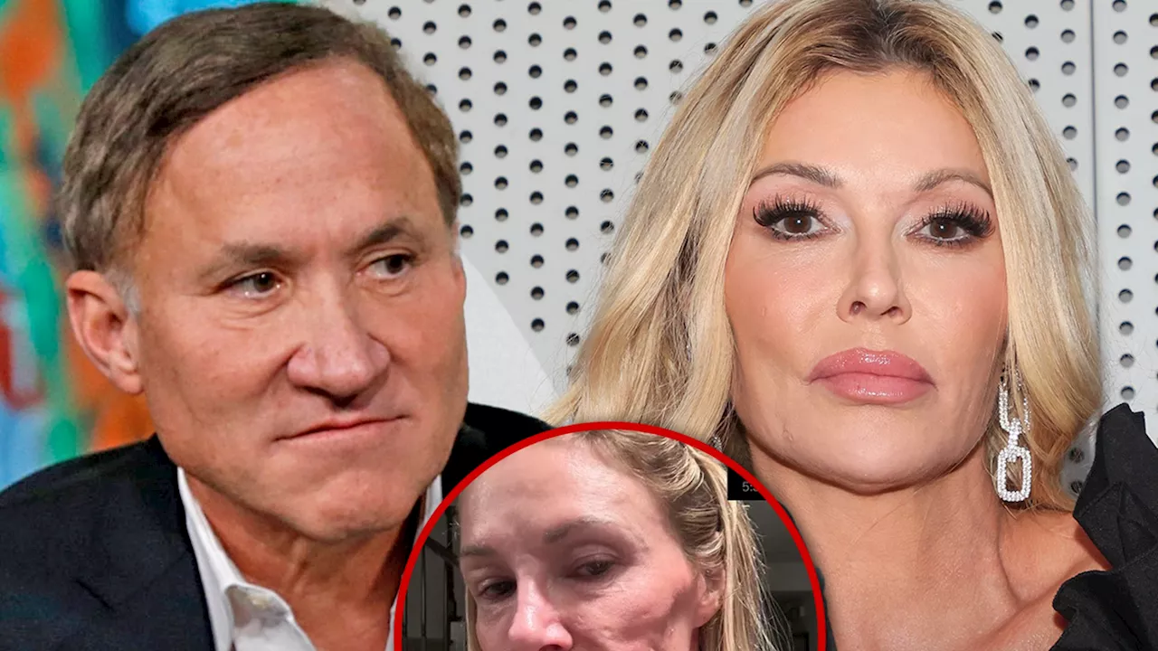 Dr. Terry Dubrow May Suggest Surgery for Brandi Glanville, She Wants Her Face Back