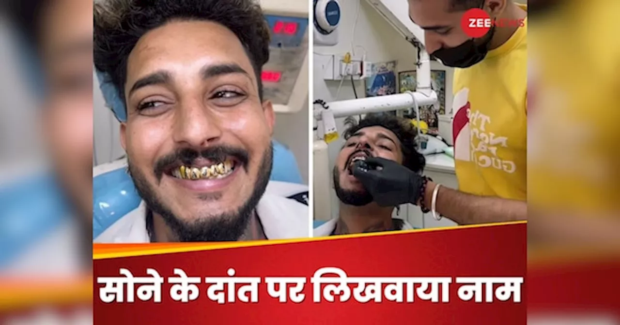 मुंह में लगवाएं 5 सोने के दांत, उसपे लिखवाया अपना नाम... Video देख लोग बोले- छपरी है क्या?