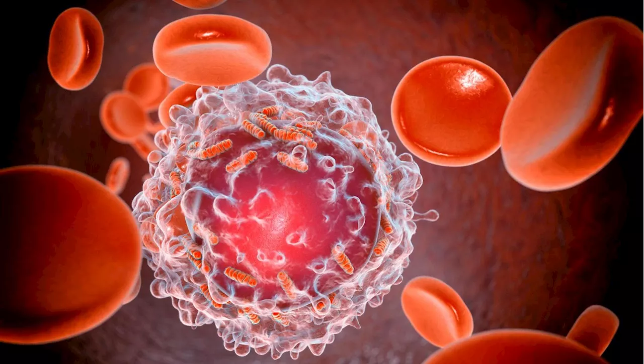 La Leucemia Mieloide Cronica: Una Malattia Cronica che Diventa Cronica