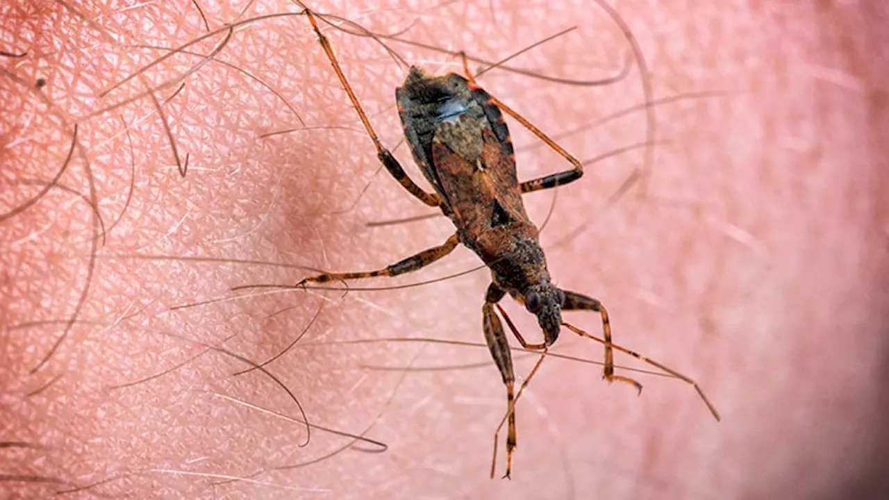 CDC Suspends Chagas Disease Testing, Re-evaluates Some ID Diagnostics