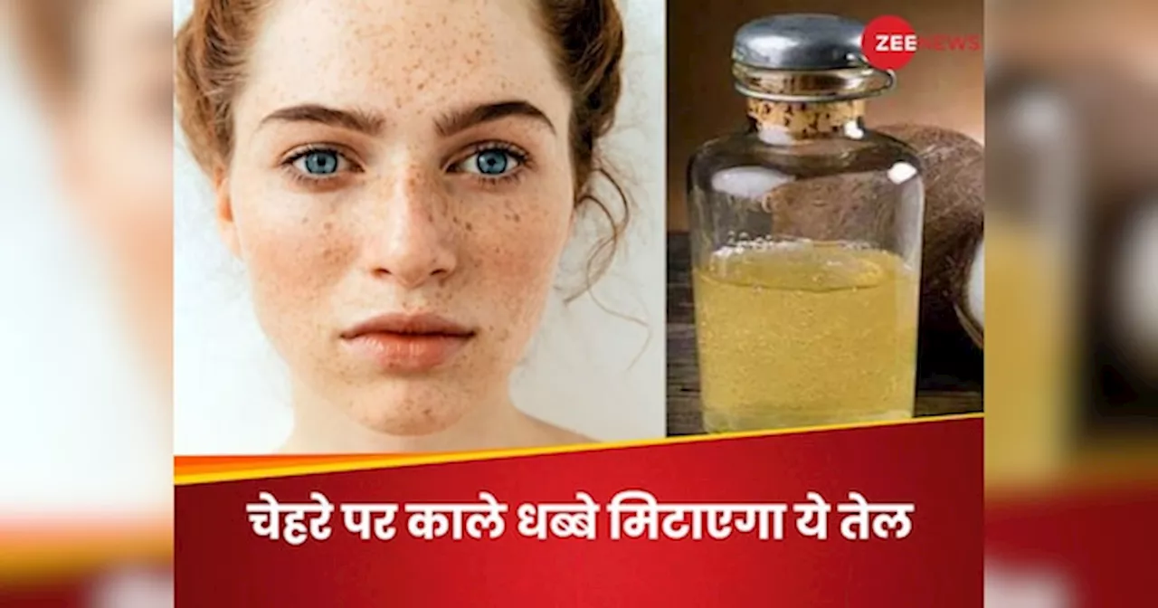 Skin Care: इस ऑयल की मदद से दूर होंगे फेस के डार्क स्पॉट्स, लेकिन संभलकर करें इस्तेमाल