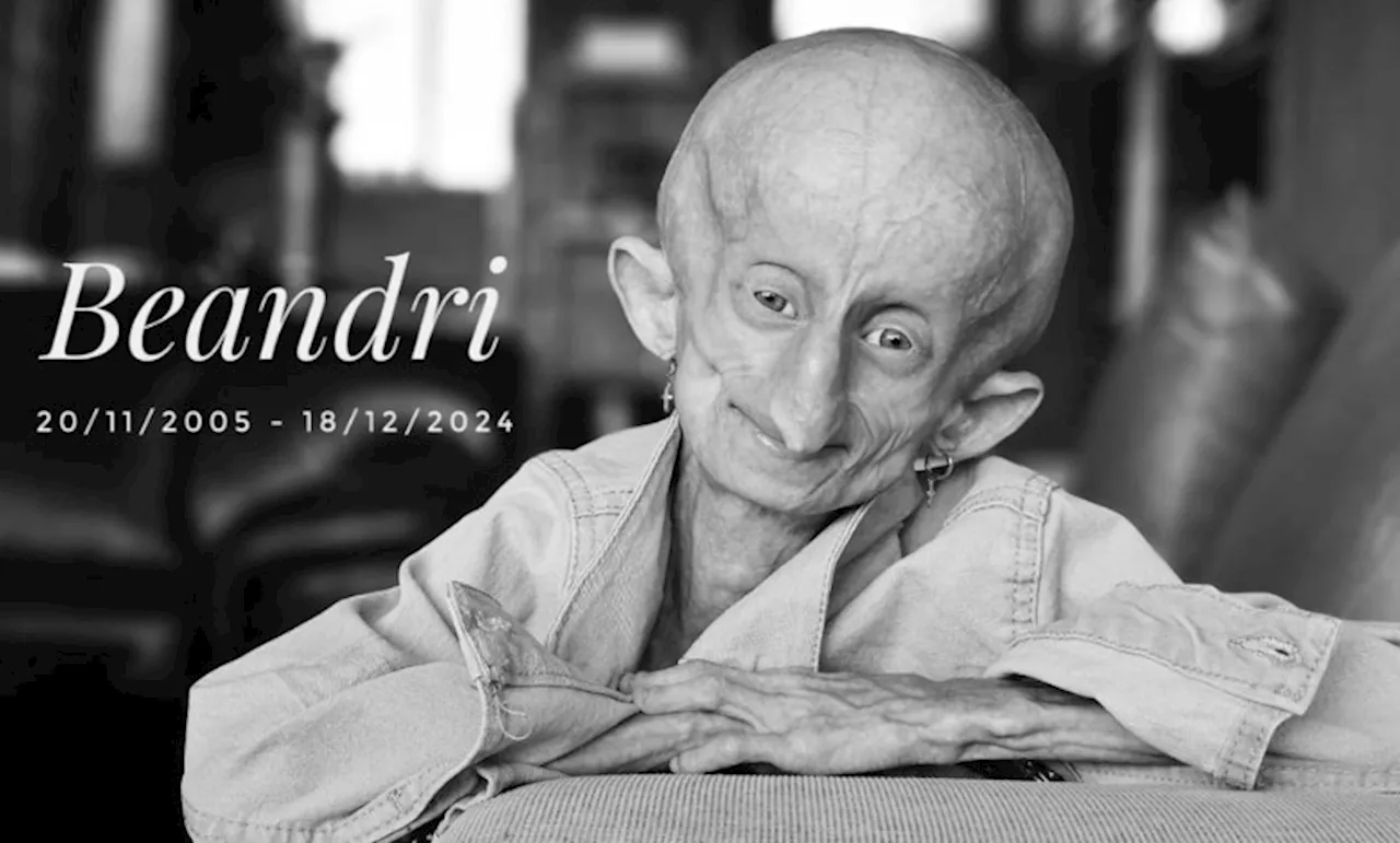 Beandri, Young South African with Progeria, Passes Away at 19