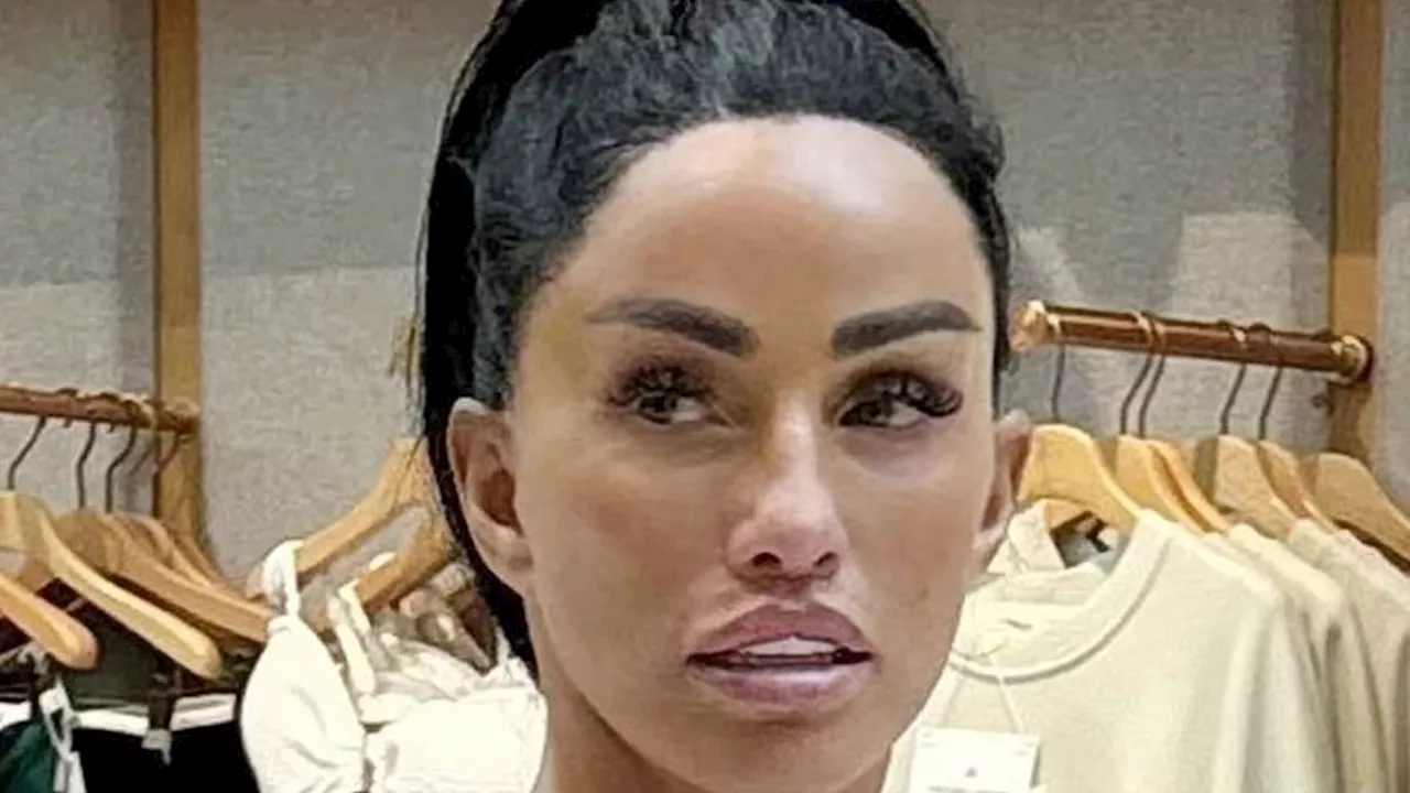 Bankrupt Katie Price Flaunts Hairline After £10,000 Turkey Facelift