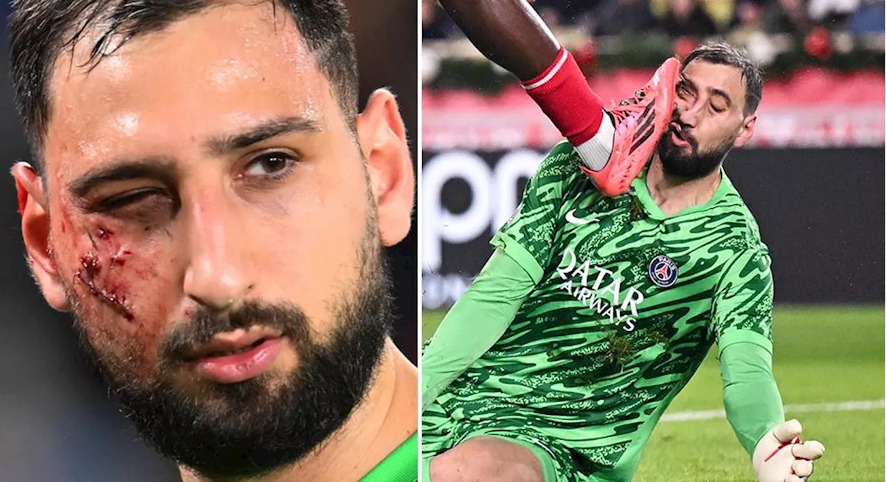 Donnarumma skadad, PSG vinner drama i Monaco