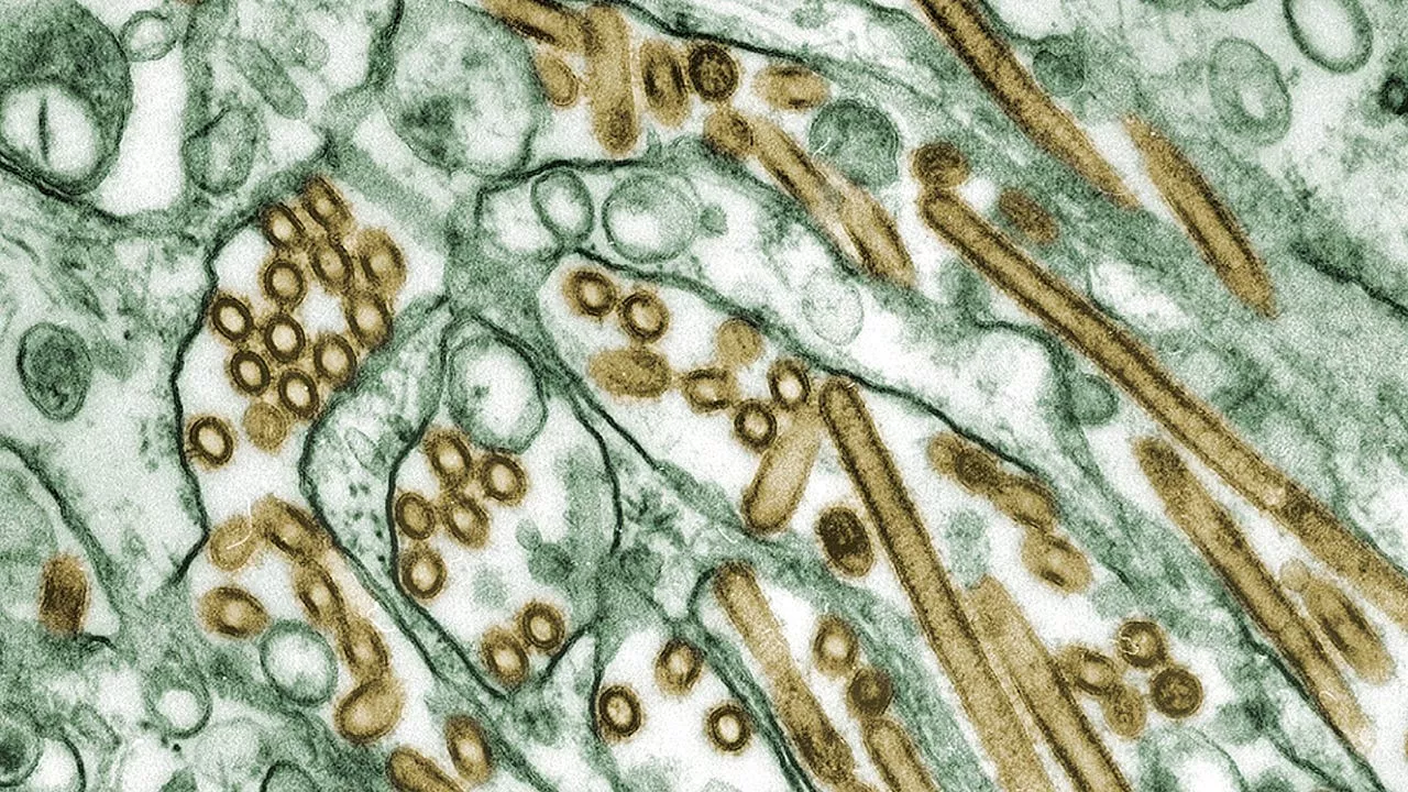 Severe human case of bird flu confirmed in Louisiana, CDC says