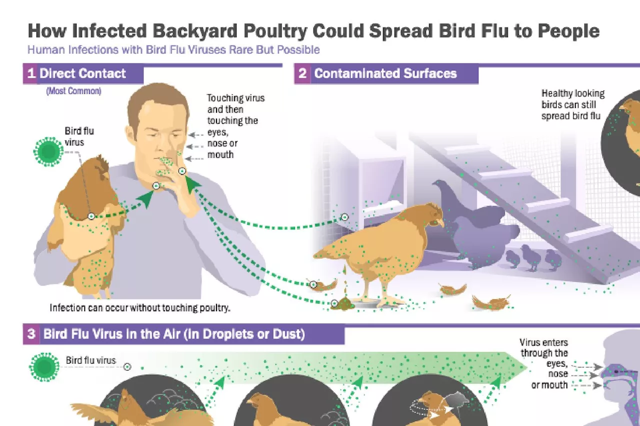 First Severe Case of H5N1 Bird Flu Detected in the US