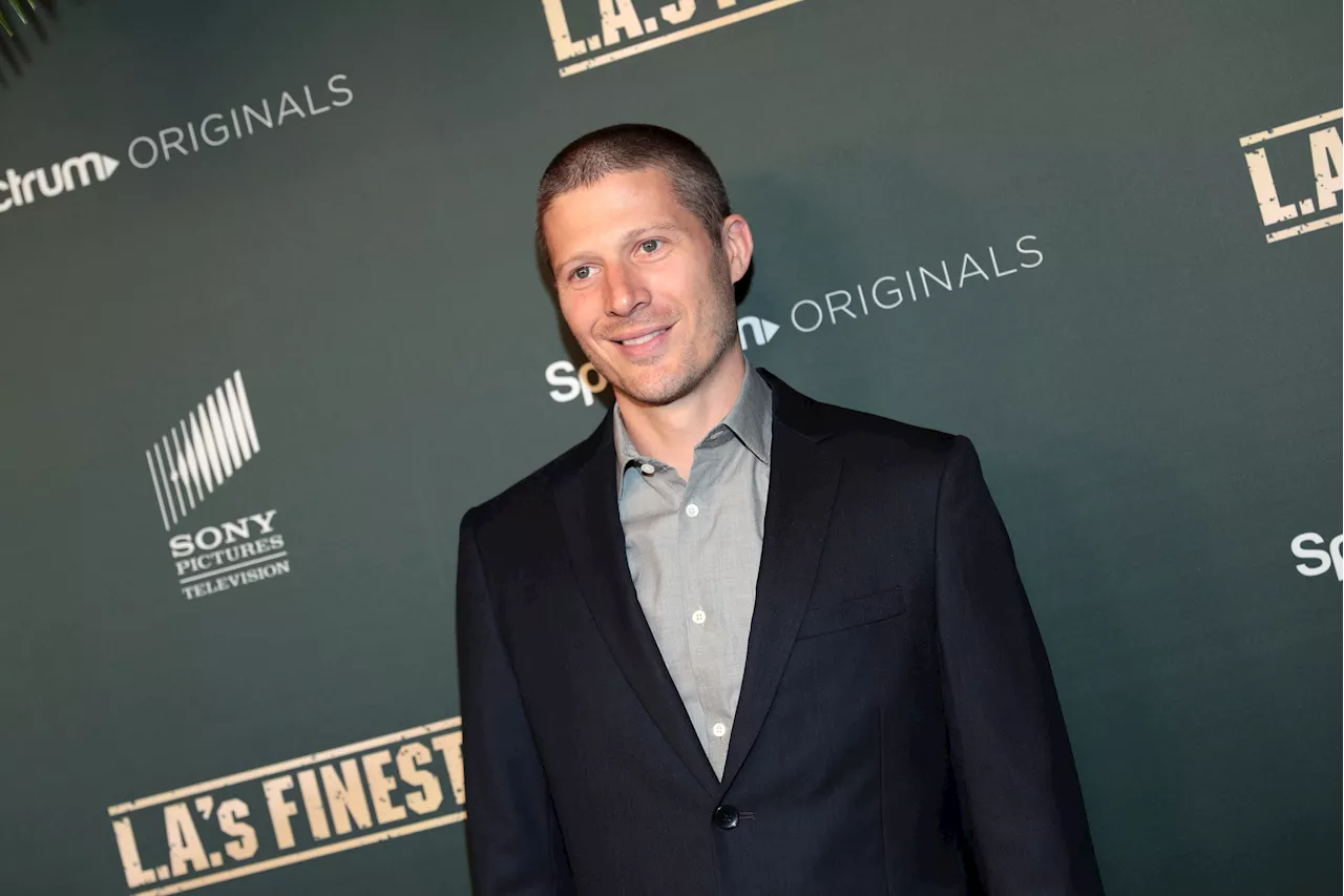 Zach Gilford Suffers Allergic Reaction, Swollen Face