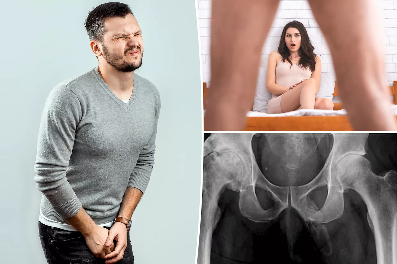 Man's Penis Turns to Bone After Routine Doctor Visit