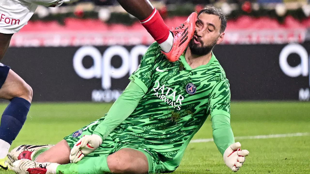 Monaco-PSG: les images impressionnantes du visage en sang de Donnarumma après une semelle de Singo