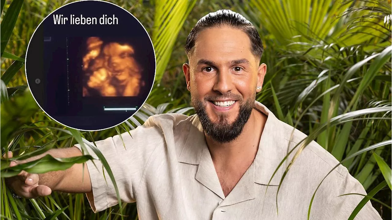 Dschungelcamp-Kandidat Maurice Dziwak zeigt Ultraschallbild seines Babys