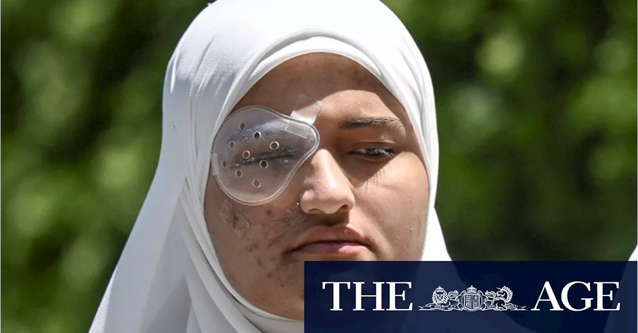 West Bank Shooting Victim Loses Eye, Sees Hope Fade