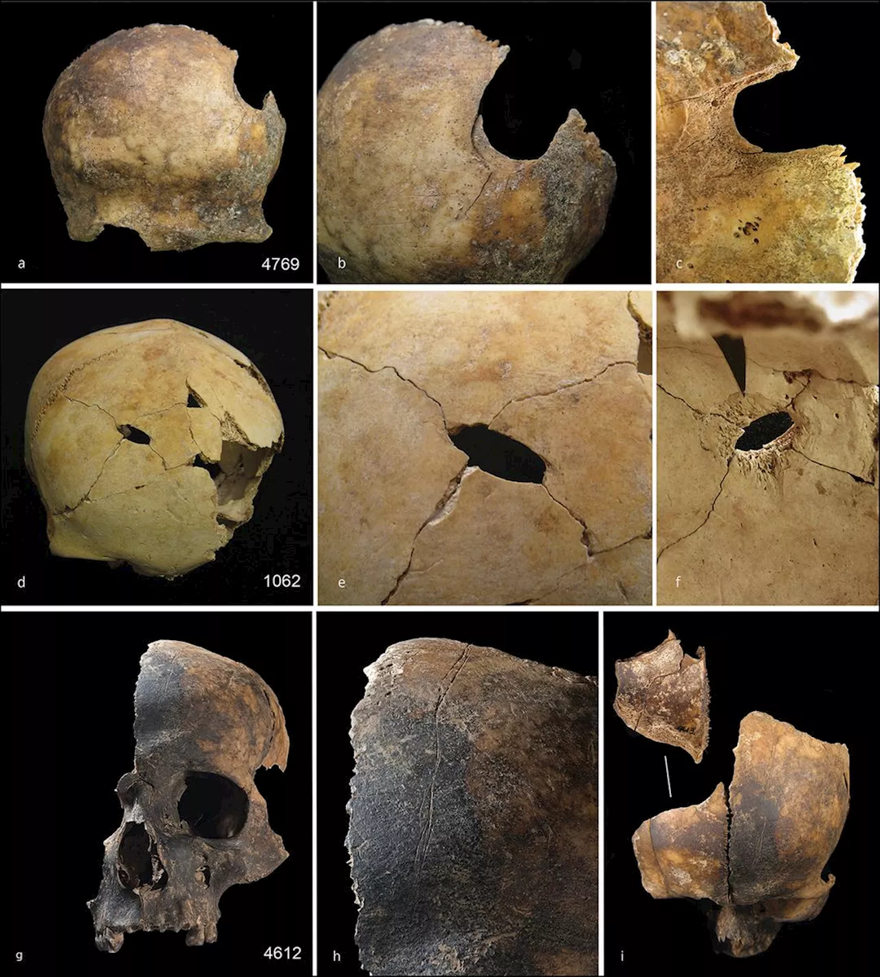 4000 År Gamle Kannibalisme-Tegn Funnet i England