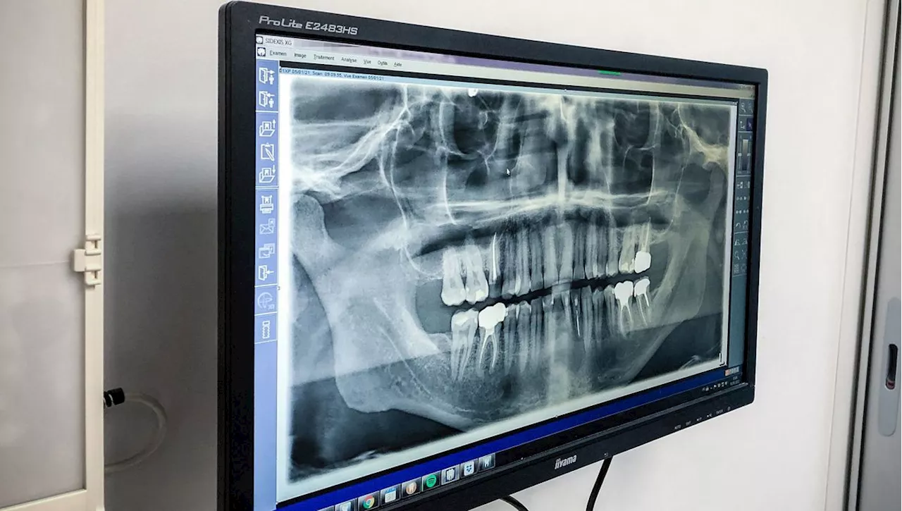 Une Nouvelle Technique Pour Stimuler La Repousse Des Dents