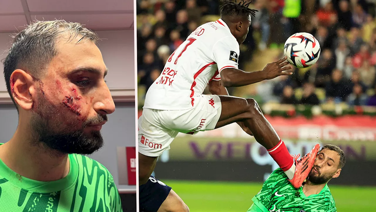 Donnarumma nach brutalem Treffer ins Gesicht mehrere Tage ausfallen