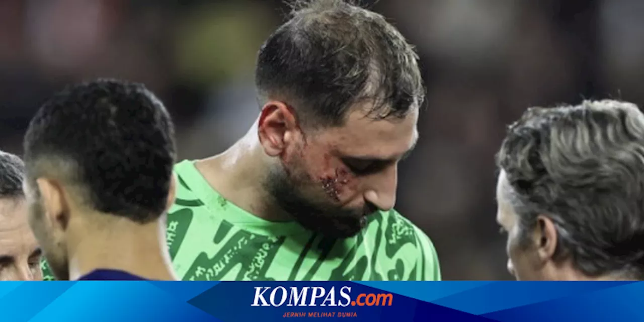 PSG Bertahan di Puncak Klasemen Liga Prancis, Donnarumma Cedera Parah