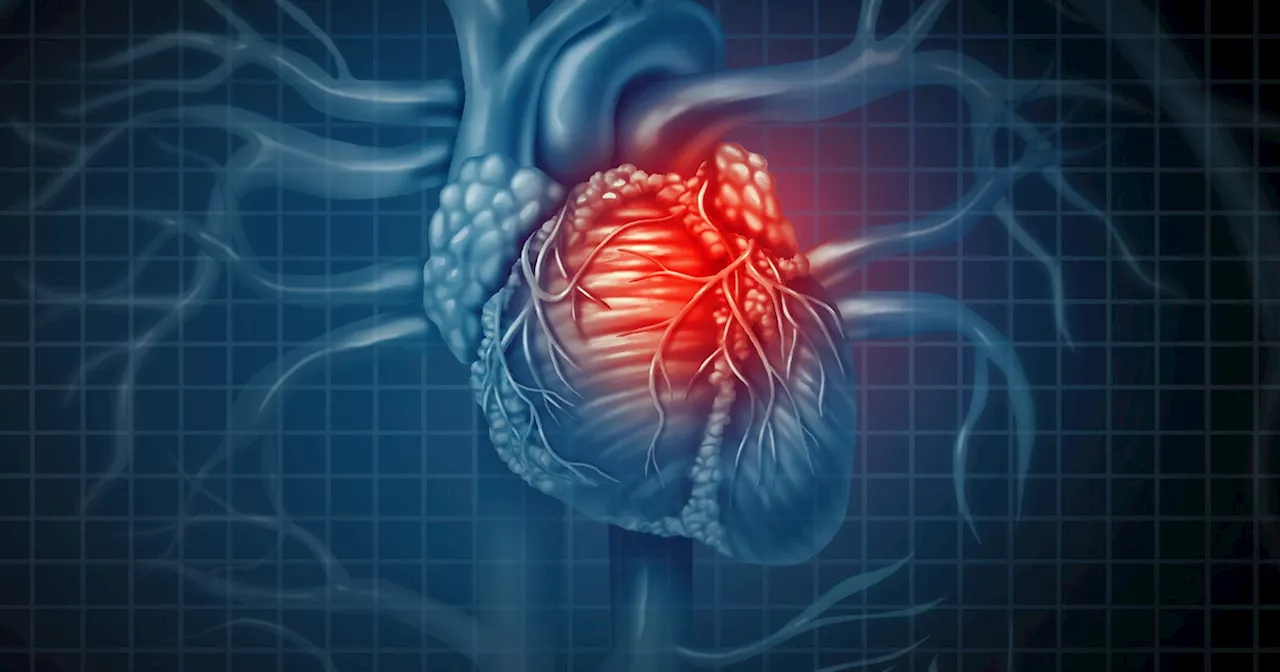 Sostanze Chimiche Nelle Plastiche: Legame con Morti e Malattie Cardiache