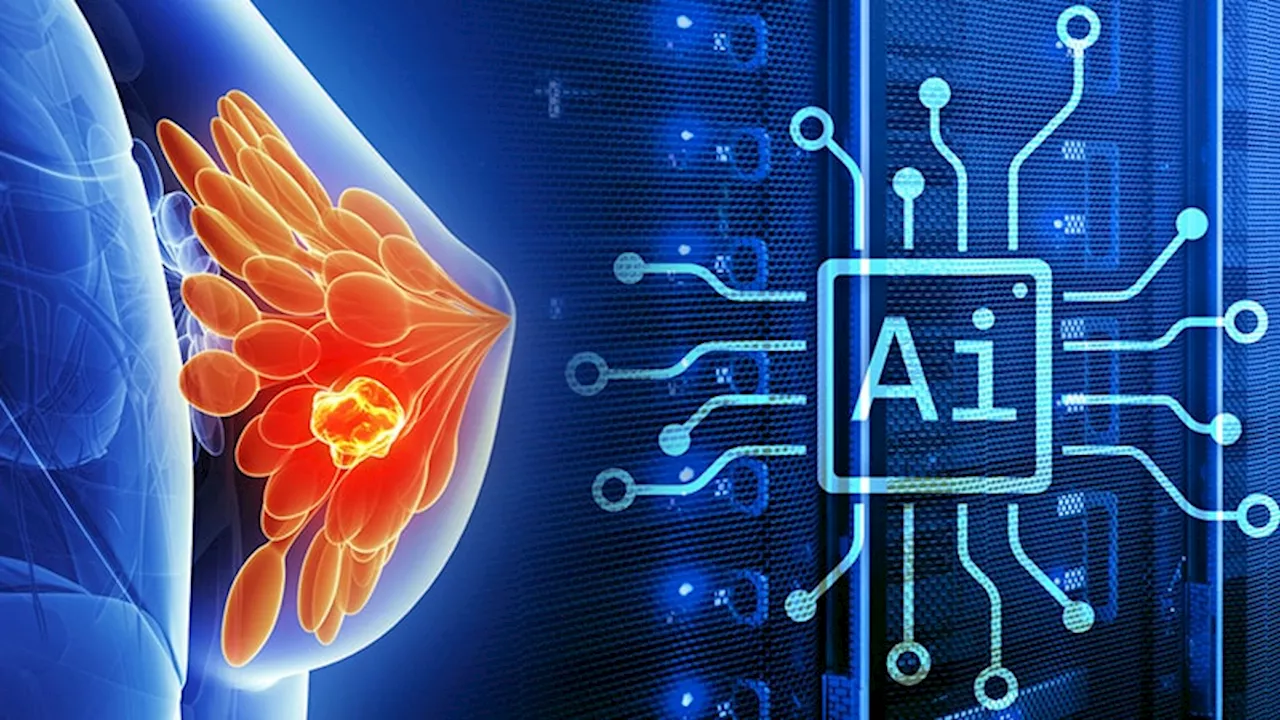 Machine Learning Model Predicts Benefit of CDK4/6 Inhibitors in Metastatic Breast Cancer