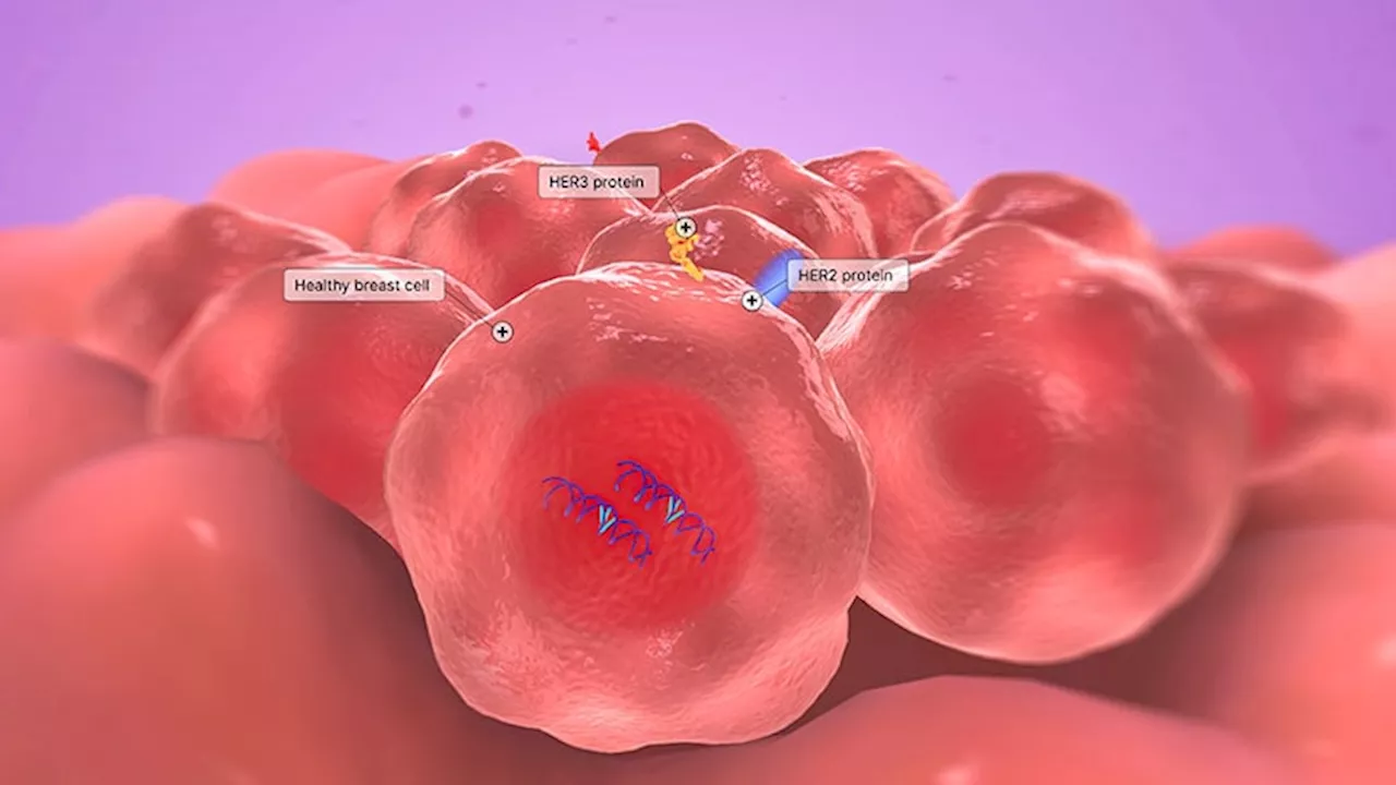 Trastuzumab Deruxtecan Shows Promise for HR+/HER2-Low/Ultra-Low Metastatic Breast Cancer