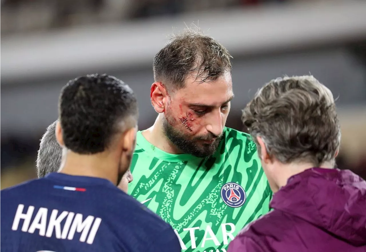 Donnarumma Verletzung: PSG verliert gegen Monaco