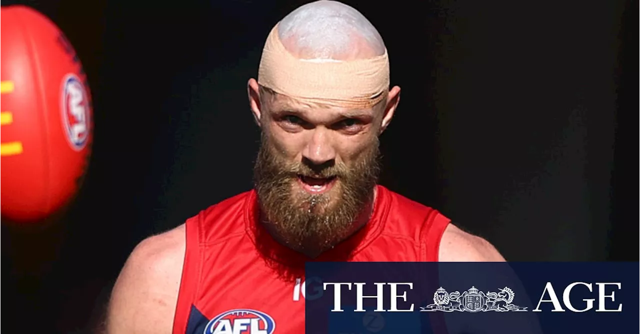 Max Gawn Sidelined for Six Weeks with Fractured Larynx