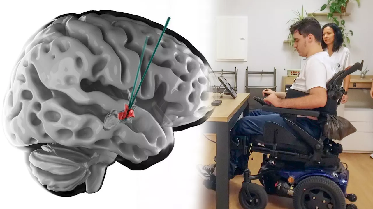 Dos parapléjlicos vuelven a caminar tras estimular una parte del cerebroasociada a la sed