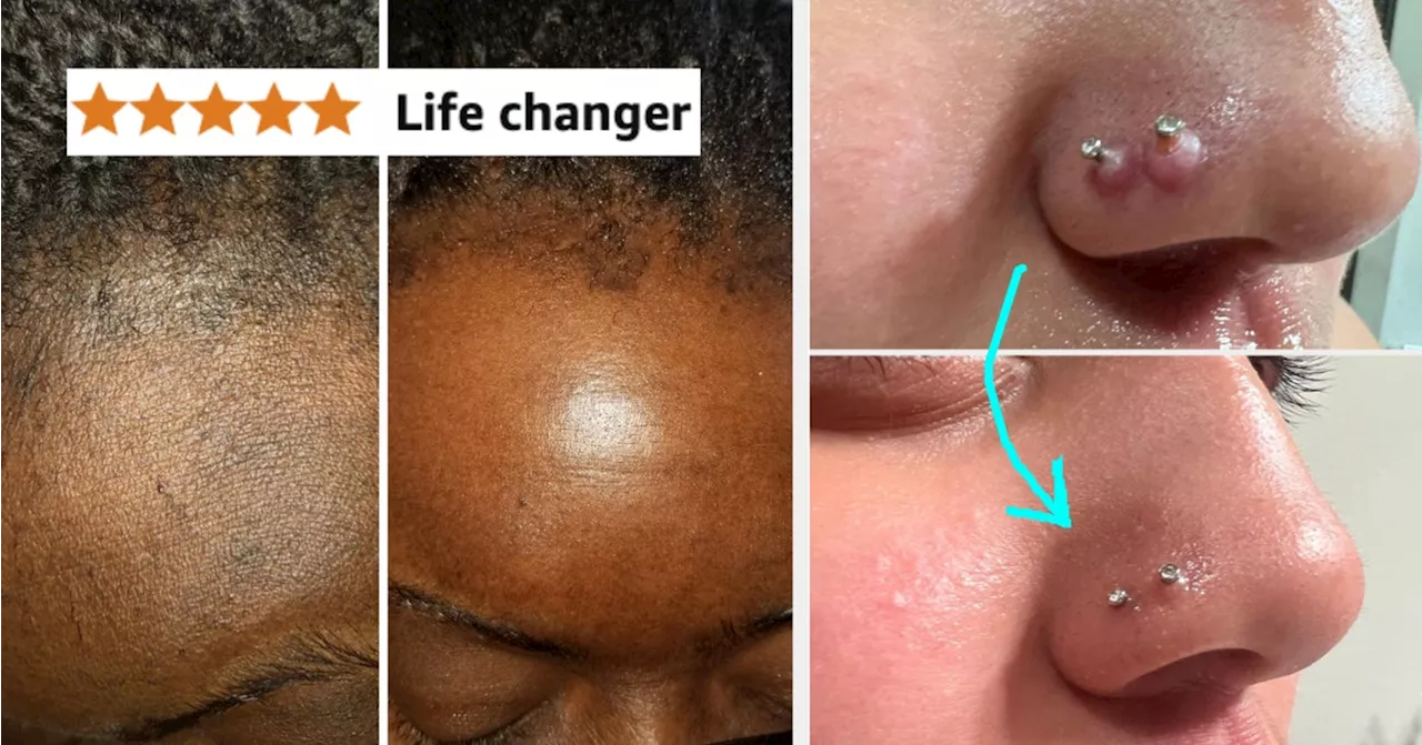 35 Personal Care Products With Before And After Pics