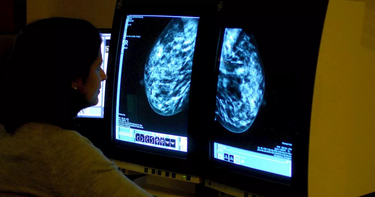 Tablet for breast cancer coming to NHS - what expert Manchester doctor says