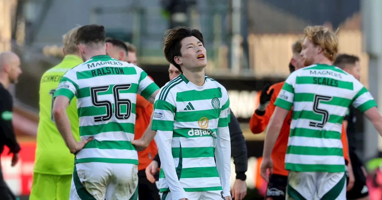 Sluggish Celtic held by dogged Dundee United as Brendan Rodgers left frustrated