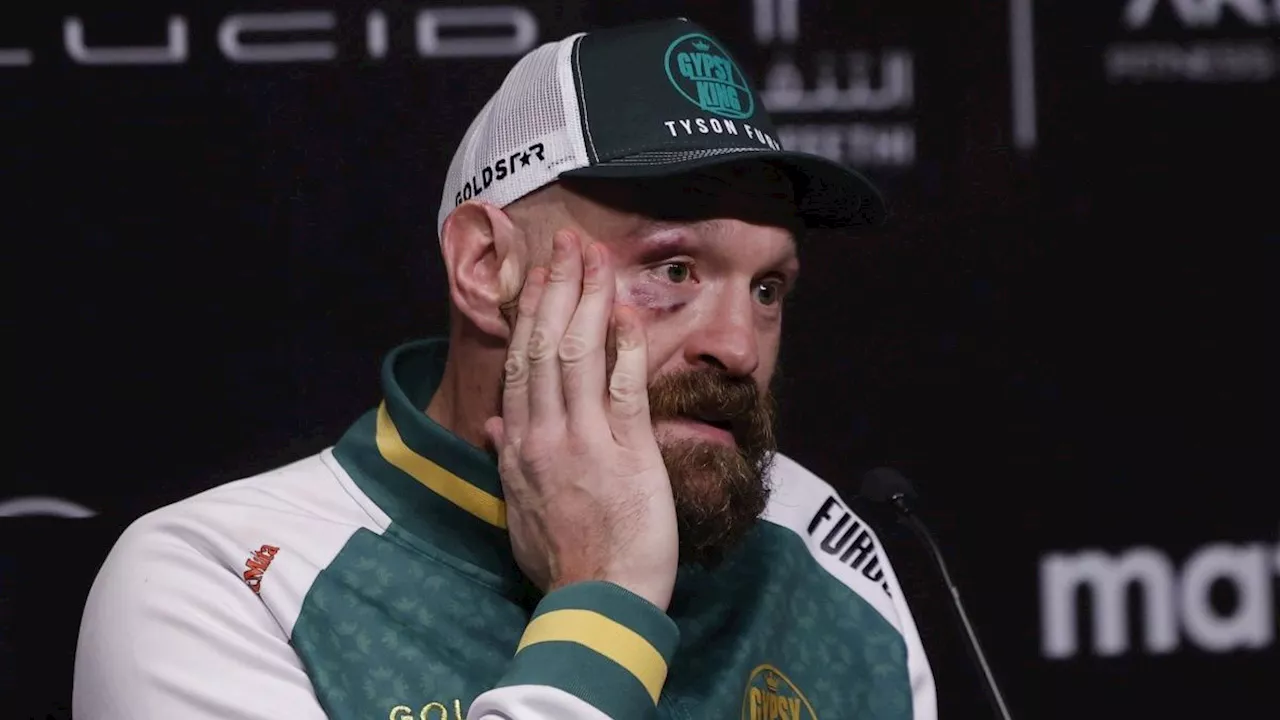 It's time to say goodbye to Tyson Fury