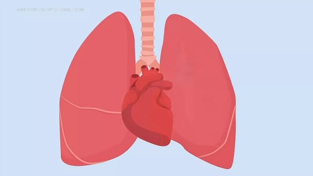 New Drug Offers Hope for Pulmonary Hypertension Patients