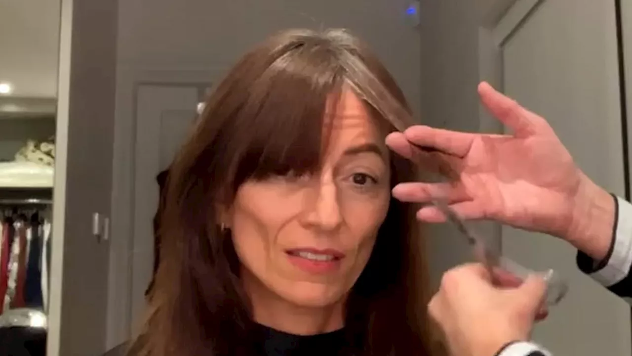 Davina McCall Reveals Hair Loss After Children and Brain Surgery