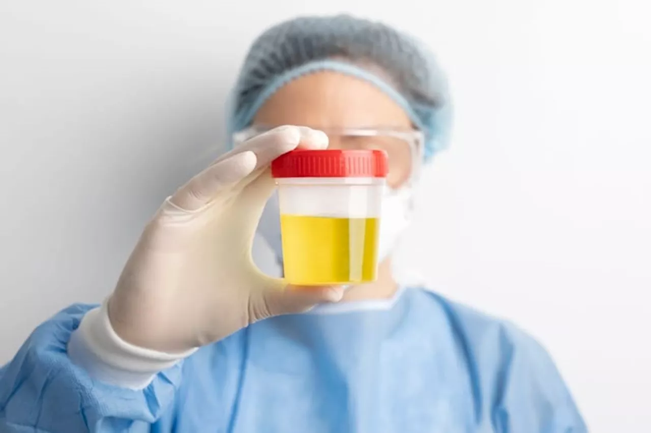 Perubahan Warna Urine Kuning Setelah Mengonsumsi Vitamin