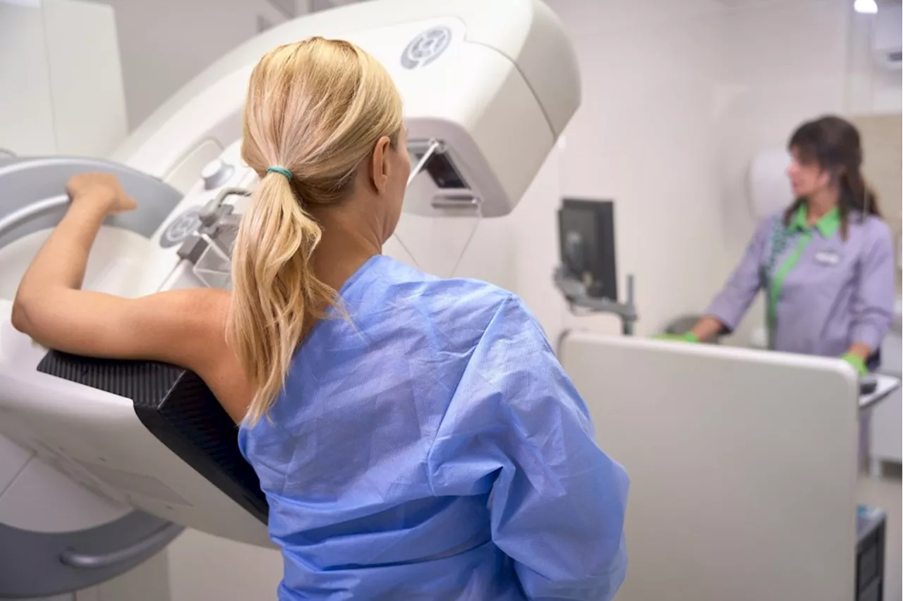 3D Mammography (DBT) Detects Cancers Earlier Than Traditional Mammography