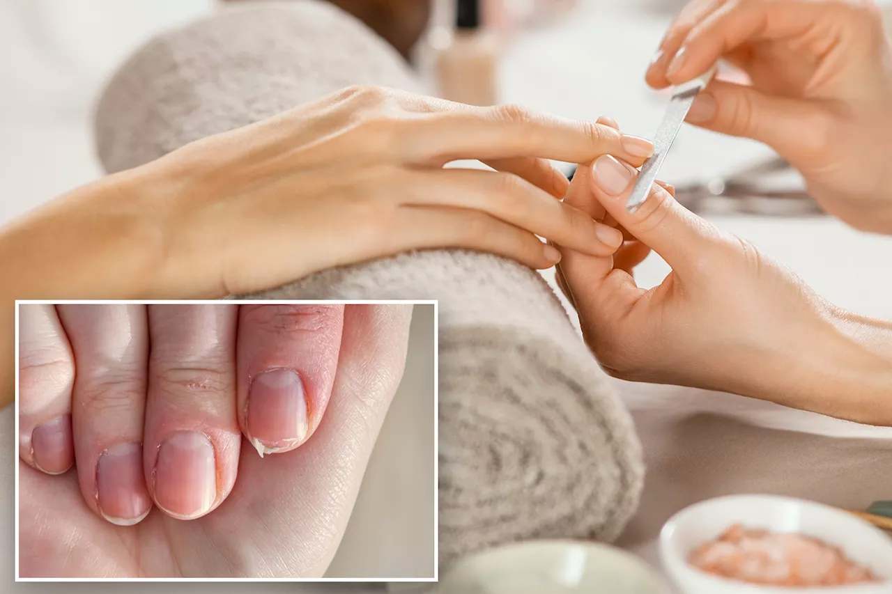  How to make your weak, brittle nails grow stronger — and the manicure mistakes doing damage