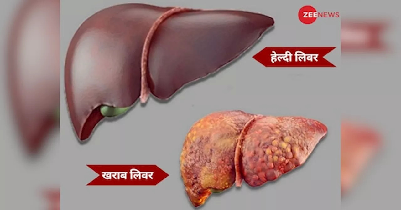 शराब के सेवन से लिवर को होने वाले नुकसान को कम करने के लिए आयुर्वेदिक उपाय