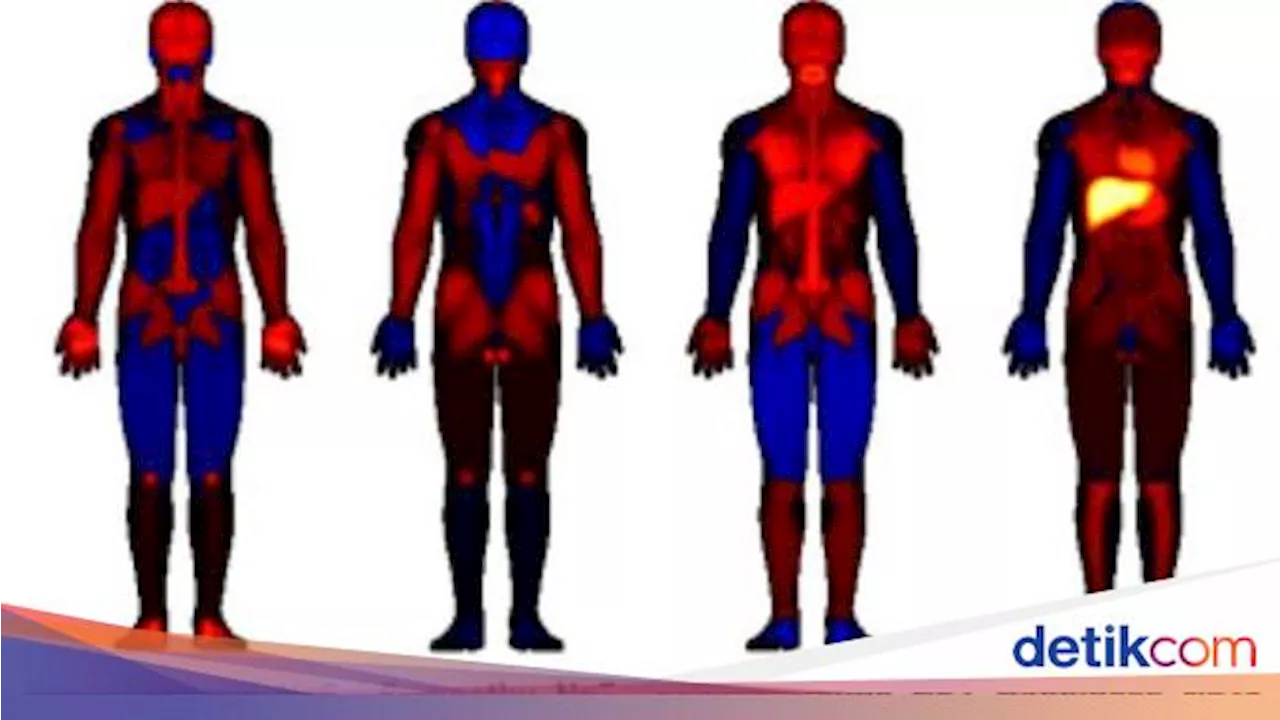 Masyarakat Mesopotamia Ternyata 'Merasakan' Emosi di Bagian Paha, Kok Bisa?