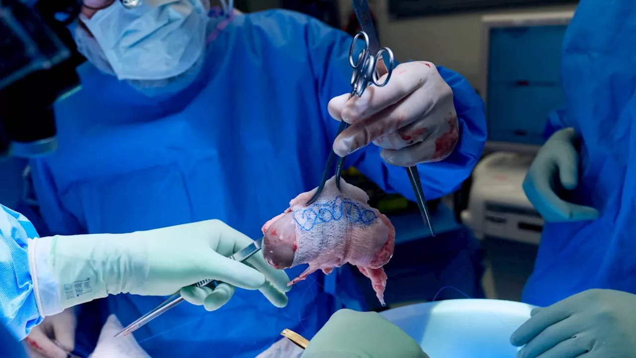 Première Transplantation de Rein de Porc Génétiquement Modifié