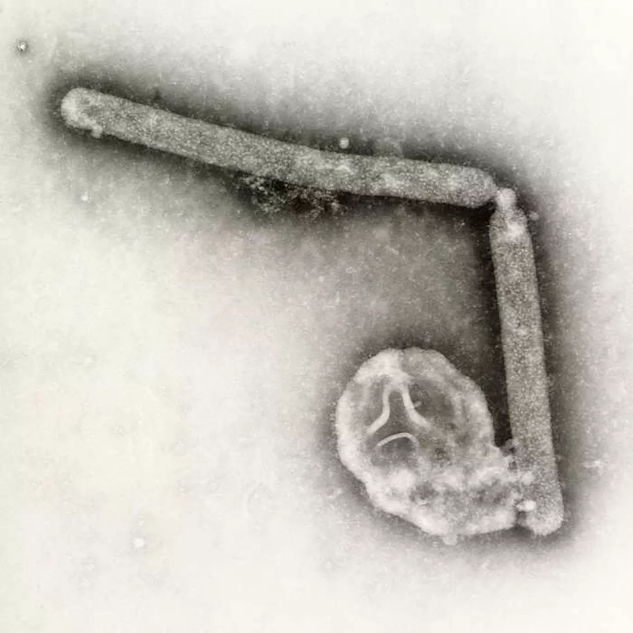 Bird flu virus likely mutated within a Louisiana patient, CDC says