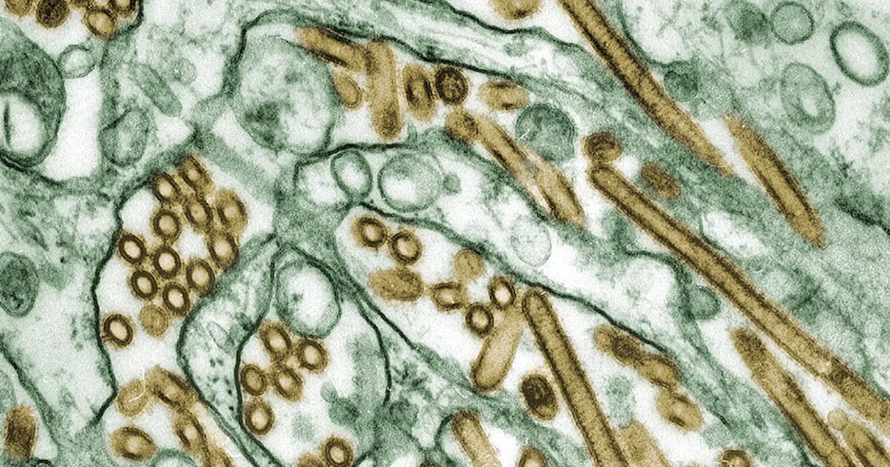 Louisiana Bird Flu Patient Shows Mutations Potentially Increasing Human Transmission