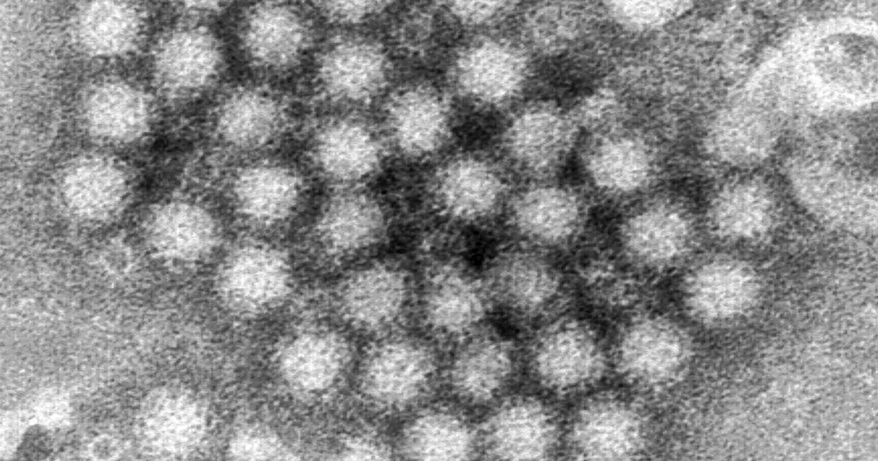 Norovirus Outbreaks Surge in the US This Winter