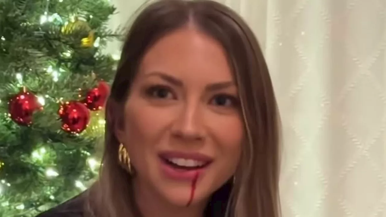 Stassi Schroeder Suffers Bloody Mishap During Playtime With Daughter