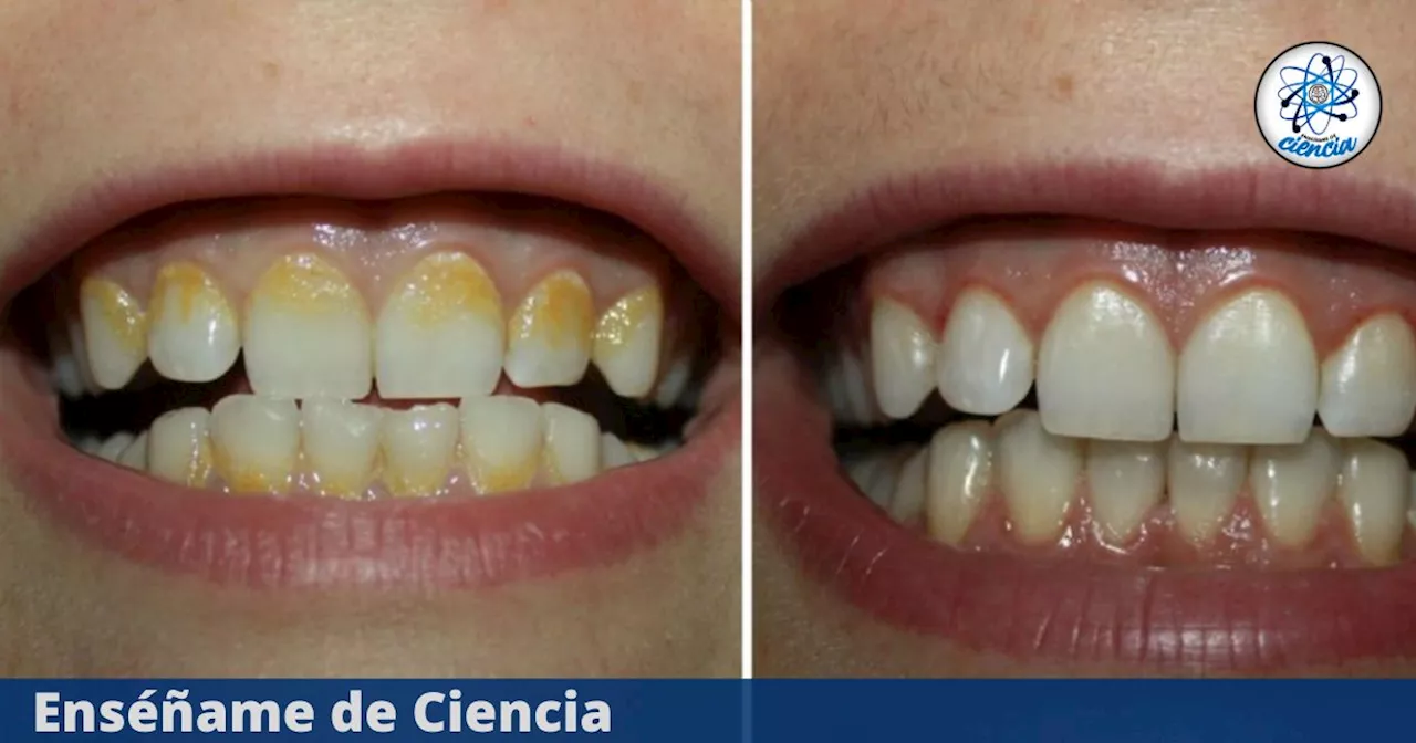 Elimina el sarro dental naturalmente con esta bebida