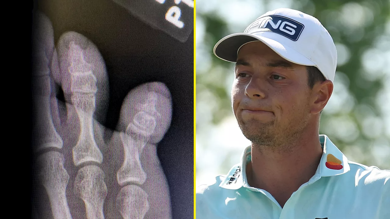 Scottie Scheffler Misses PGA Tour Opener After Christmas Day Injury