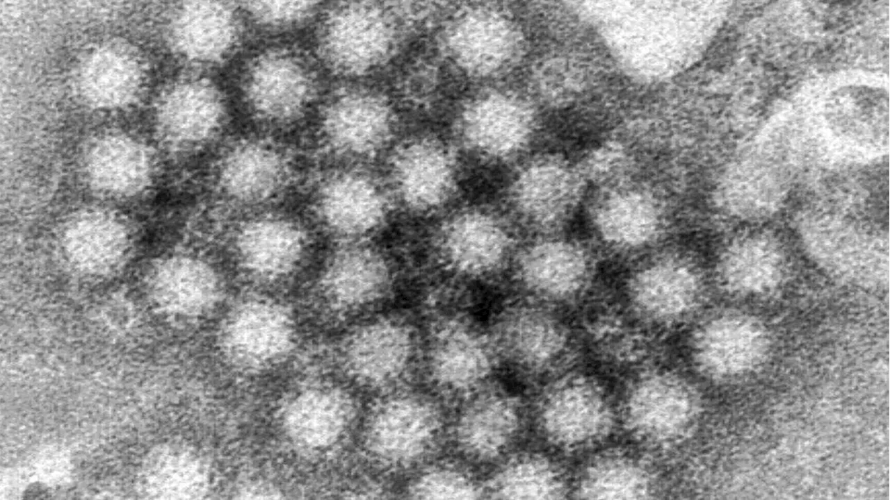 Norovirus Outbreaks Surge in the US this Winter