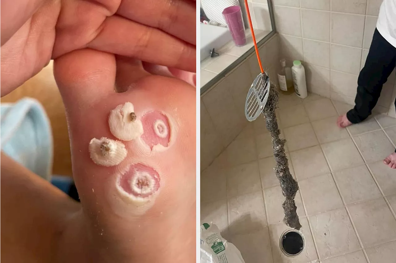 32 Products to Solve Your Most Embarrassing Problems