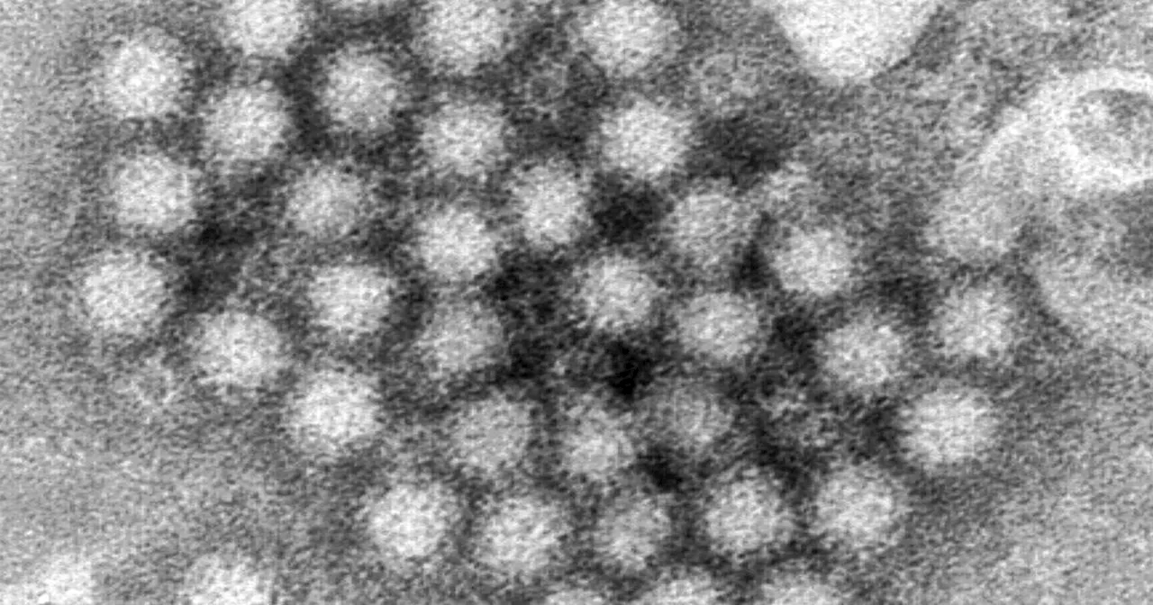 Norovirus Cases Surge in the US This Winter